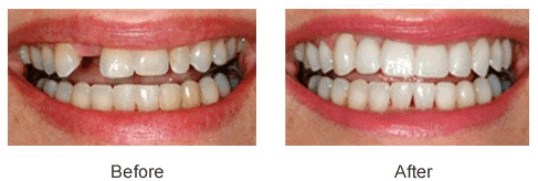 Periodontist in Haverford