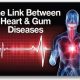 How Is Gum Disease Linked to Cardiovascular Disease?