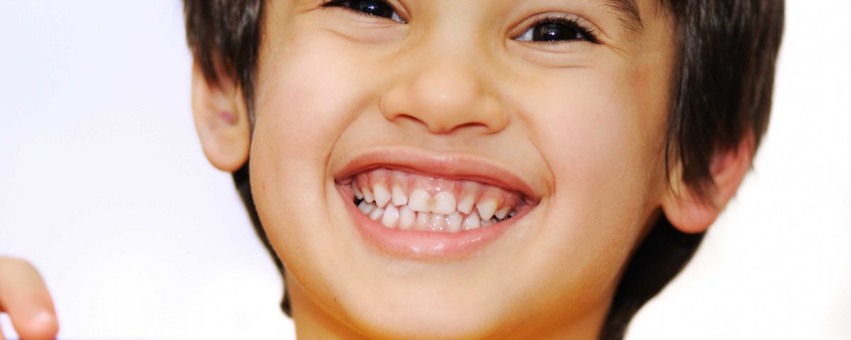 The Different Types of Periodontal Disease in Children