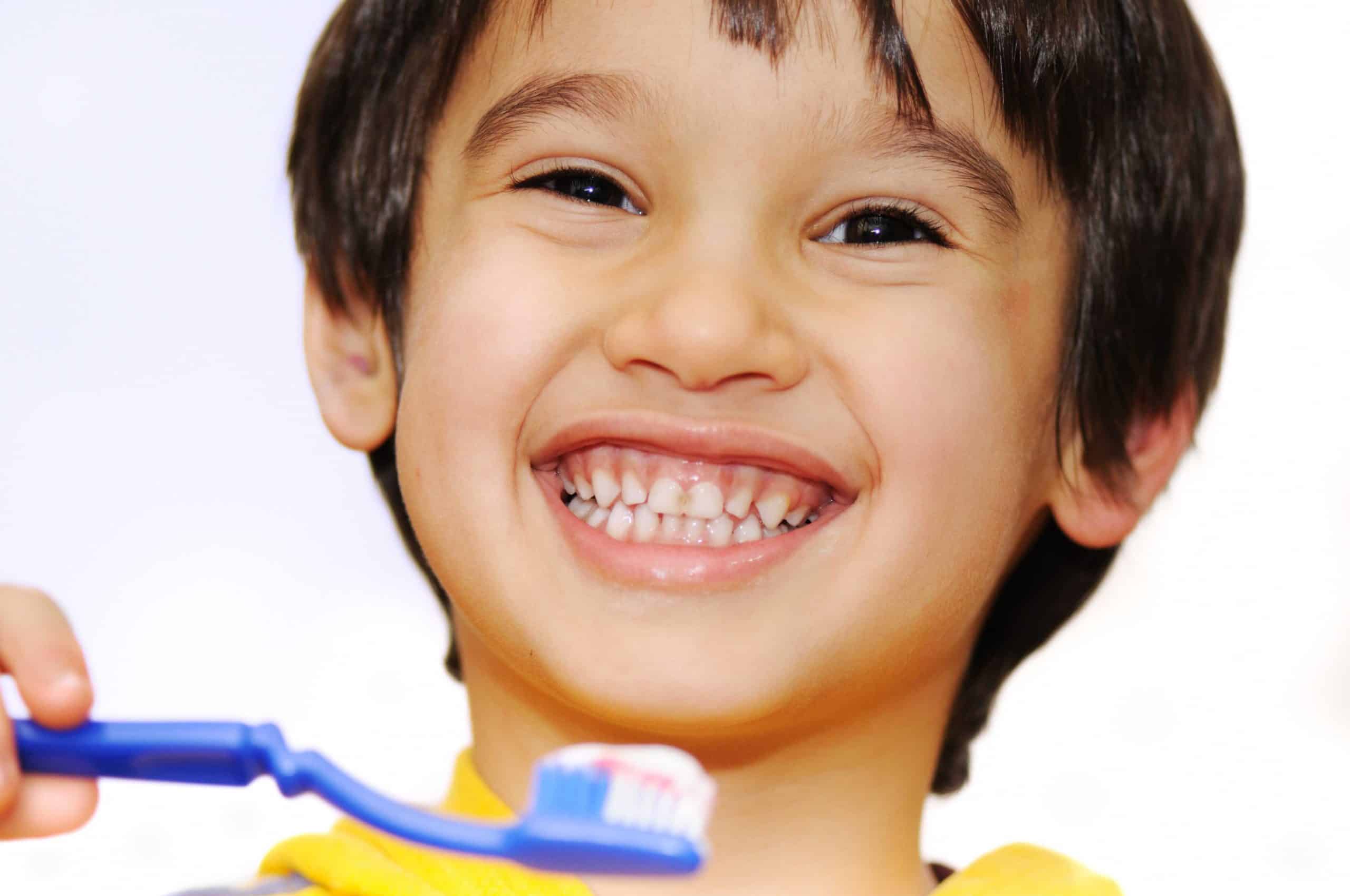 The Different Types of Periodontal Disease in Children