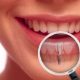 dental implants jenkintown